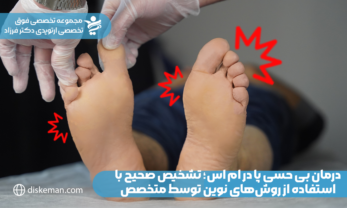 درمان بی حسی پا در ام اس؛ تشخیص صحیح با استفاده از روشهای نوین توسط متخصص